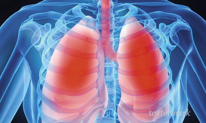 У Горішніх Плавнях збільшилась кількість хворих на туберкульоз