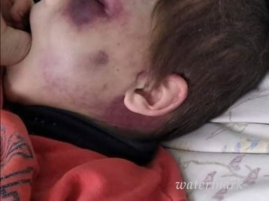 В Винницкой области отец зверски заездил 6-летнего сына: детали ЧП(фото)